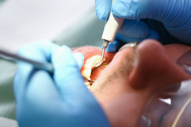 Best Tooth Infection Emergency Dentist  in Chadwicks, NY
